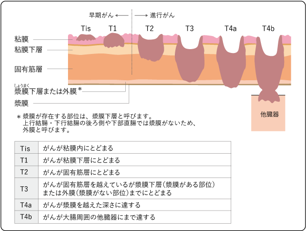 便秘症:画像検査からみた便秘の病態| 症例別の取り組み |