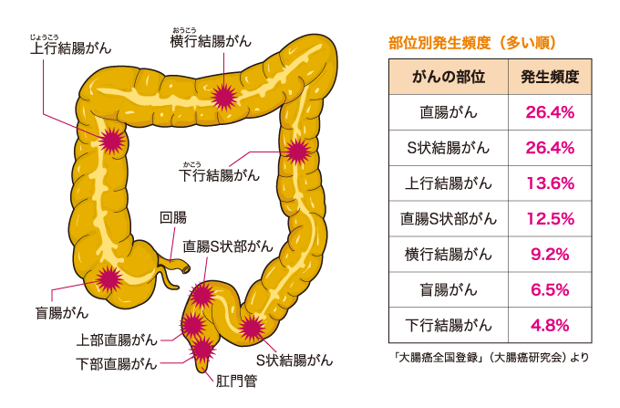 Amazon.co.jp: 認定資格取得のための腹腔鏡下S状結腸切除術徹底レクチャー(DVD付) : 伊藤雅昭: